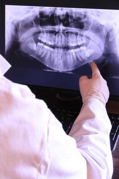 Best Emergency Tooth Extraction in Magnolia Springs, AL