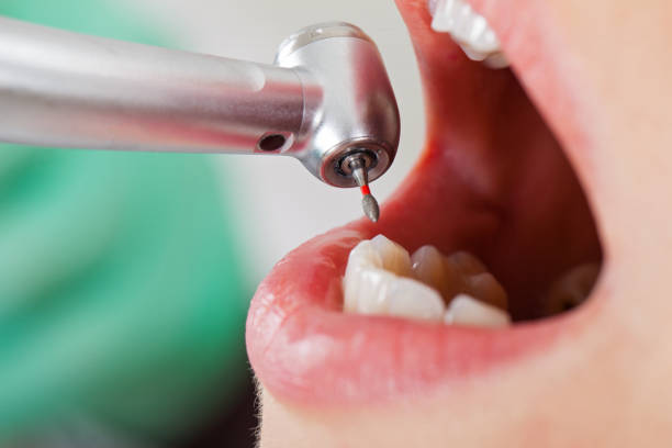 Best Same-Day Emergency Dentist in Magnolia Springs, AL